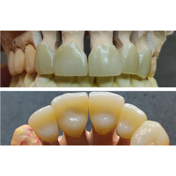 Vente chaude Nouveau matériau de laboratoire dentaire 700-1200mpa 4D Pro Bloc de zircone multicouche