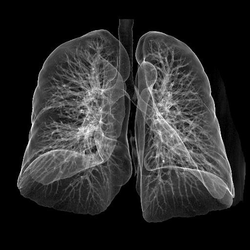 High Sharpness Medical X-Ray Film Laser Konida For CT / DR