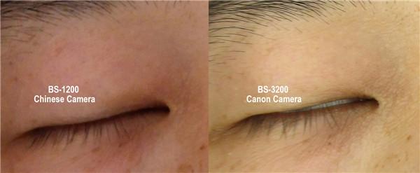 biophotonic scanner Skin analyzer and quantum resonance magnetic analyzer supplier facial skin analysis equipment