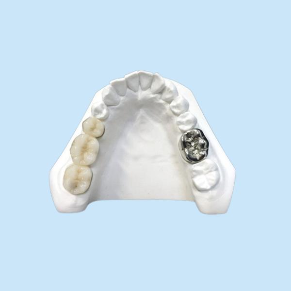 Ultra Hard Digital Porcelain Dental Crown Health Safety High Density