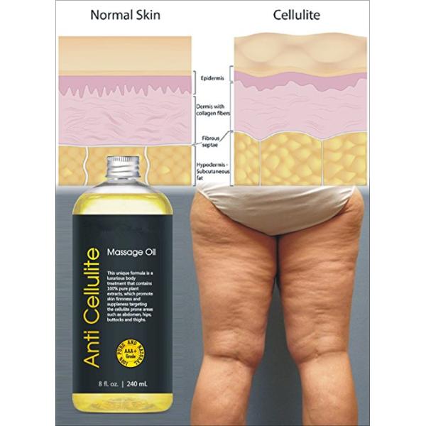 Celulitis antis de las plantas del 100% de los extractos del cuerpo del aceite puro del masaje que promueven firmeza de la piel