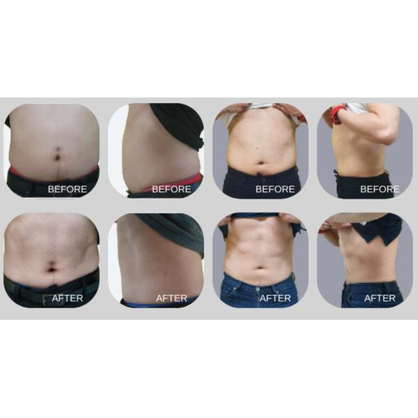 50-60hz Fat Freezing Body Sculpting Machine EMS Muscle Stimulation Machine