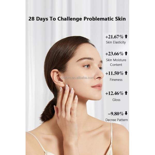 Portable Beauty Equipment LED Light Therapy Face Mask for Whitening and Acne Treatment