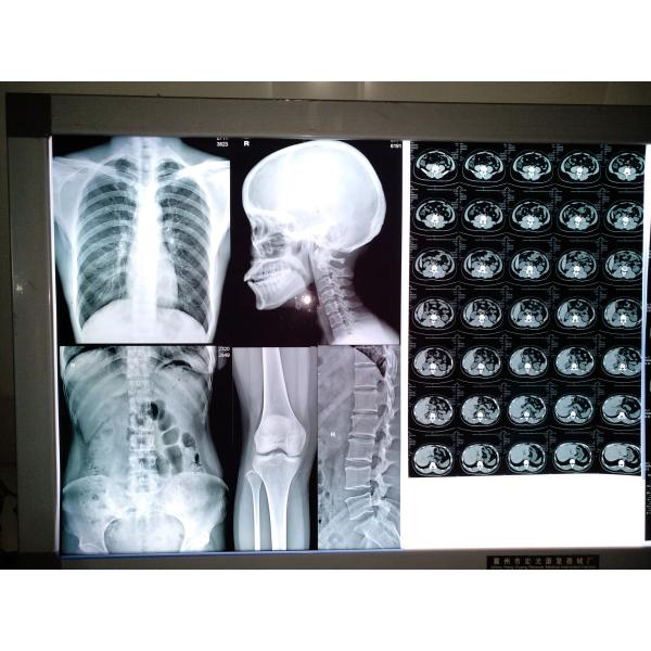 Thermal/Inkjet x ray ct scan Film Thermal dry printer Manufacture Medical film base blue sensitive medical dry film
