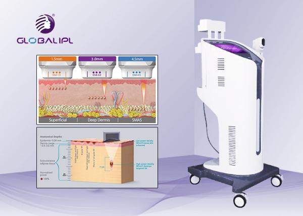 4D Wrinkle Removal HIFU Machine 4 - 7MHz Frequency With Better Curative Effect