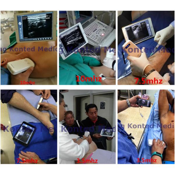 GH Medical Hospital Equipments G10LN 128E Linear Wireless Vascular Probe Ultrasound 10Mhz