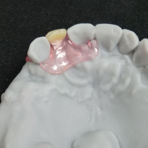 Acrylic Valplast Flexible Denture Simulates Gums Look Like Naturaling Looking