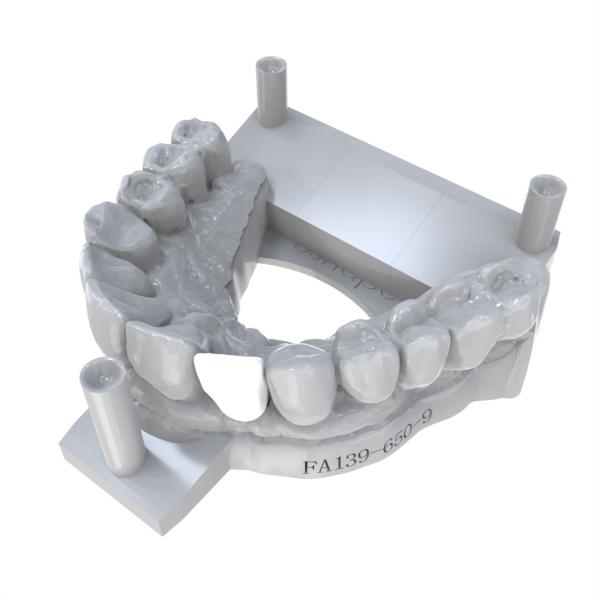 Strong Adhesion Permanent Crown Resin High Strength Long-Lasting Restorations