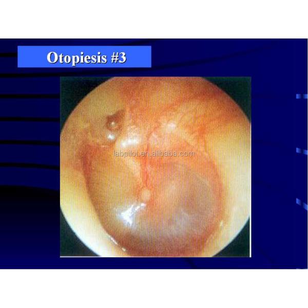 Medical Education Ear Examination Model Realistic Human Simulation with 14-pc Set