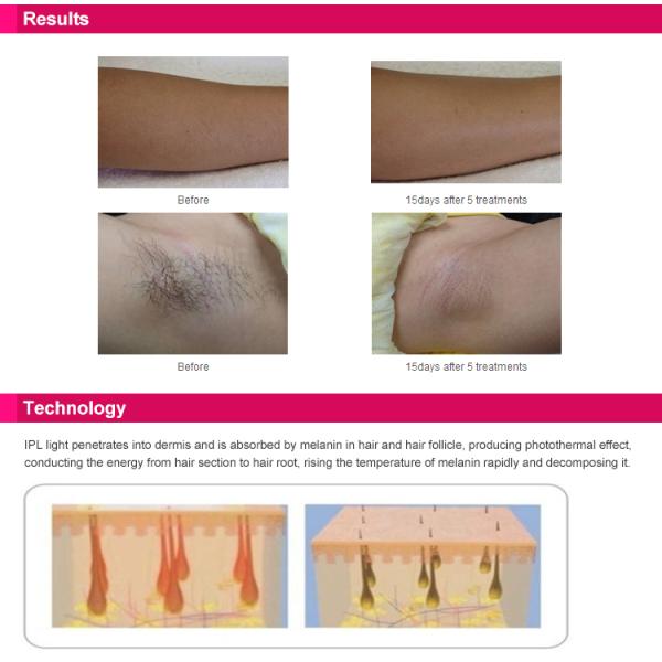 постоянная машина удаления волос 300000shots, удаление волос 3.1cm2 Deess