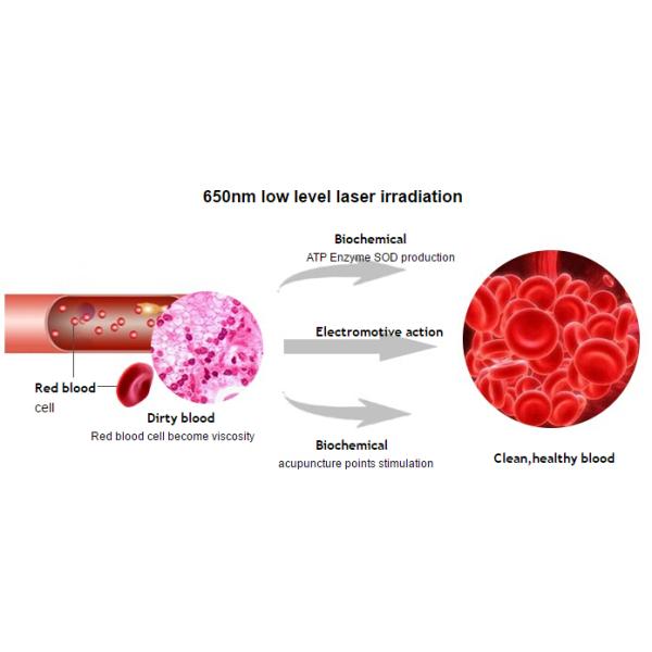 Blood Pressure Reducing Low Level Laser Therapy Watch Red And Blue Light