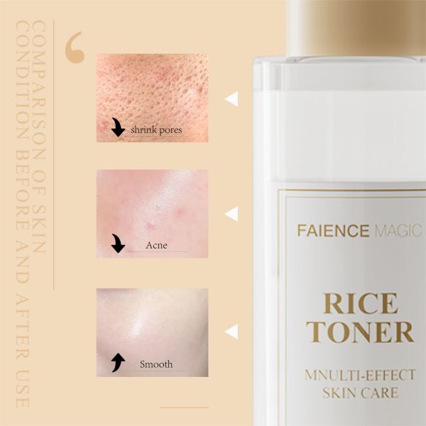 Factory Wholesale Organic Rice Facial Toner Nicotinamide Hydration Serum Moisturizer Day Night Skin Whitening Serum for Adults