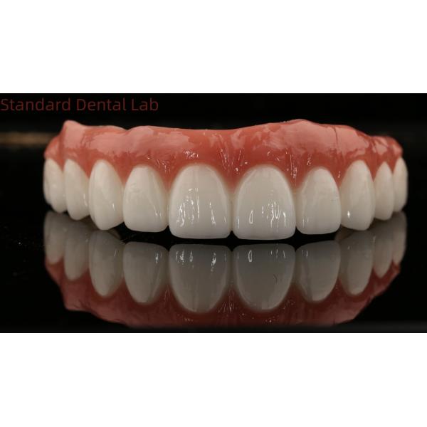 Высококачественная зубная цирконовая корона и All On Four Six Implant Full Arch