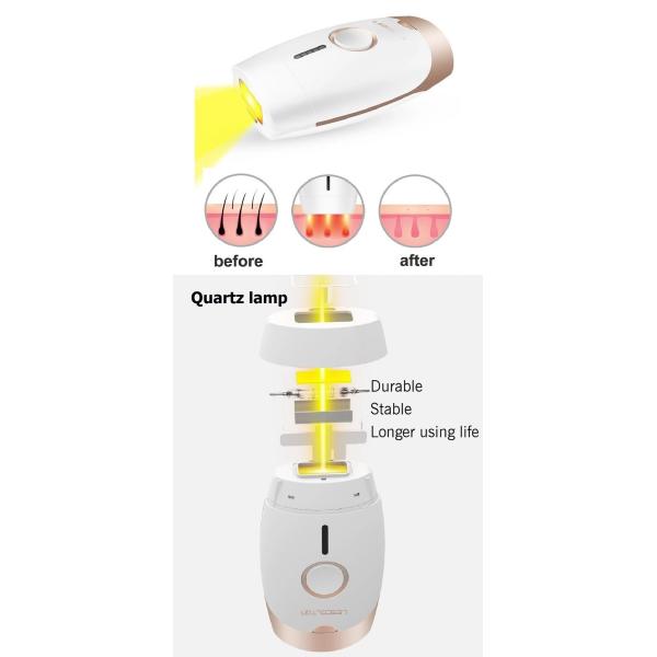 Удаление волос лазера IPL 5 шестерней CE ROHS перезаряжаемые