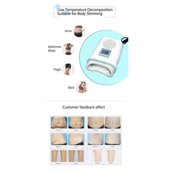 Mini Cryo Body Sculpting Machine Weight Loss Cryo Slimming Machine