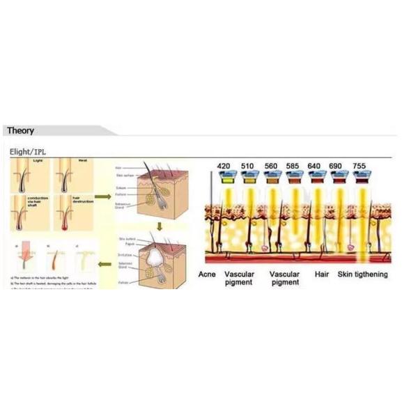 Intense Pulsed Light SHR Hair Removal Machine Three Colors Optional