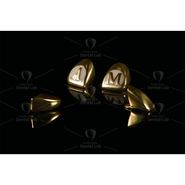 Yellow Gold 62% Full Cast Crown Saliva And Acids Resistant Gold Crown Implant