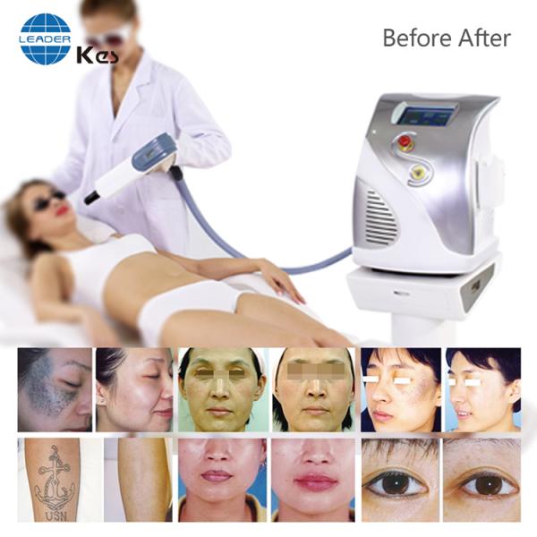Adjustable Laser Tattoo Removal Equipment Max Energy 1065nm 800mJ 532nm 400mJ