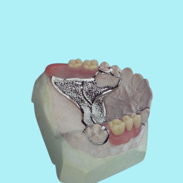 Дизайн цифрования изготовленного на заказ Denture бросания OEM съемного частично высокопрочный
