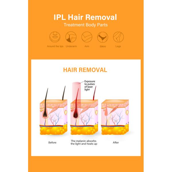 SHR SSR IPL Skin Rejuvenation Machine Home Laser Hair Removal