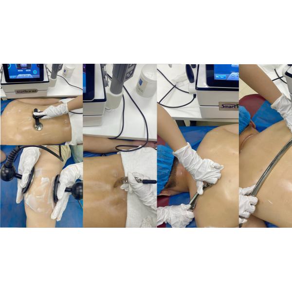 3 In 1 Tecar Diathermy EMS Shockwave Machine For Body Physiotherapy For Sport injury And Cellulite Effect