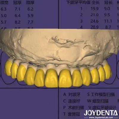 Dental Design Software Digital Wax Up With HIPAA Compliant Data Security