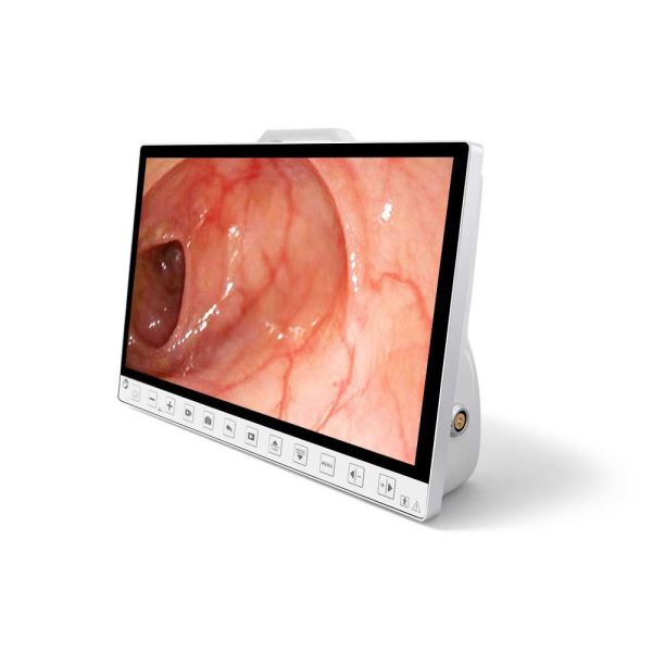 Portable 13.3 Inch 1080P Endoscopy Camera System With Recorder for Laparoscopy ENT Surgery