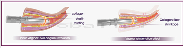 8.4'' Color Screen RF Fractional Laser Equipment For Skin Rejuvenation / Vaginal Tightening