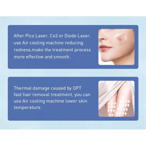 Машина кожи холодного воздуха охлаждая для аксессуаров машины красоты лазера Cryo IPL