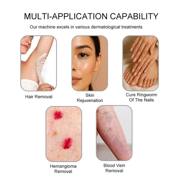Compact Alexandrite Laser Device Featuring Advanced Cooling and Variable Frequency for Comfortable Patient Experience