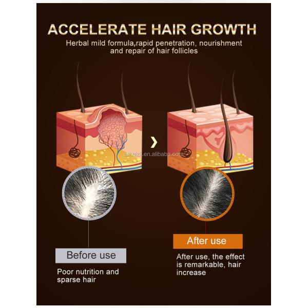 Natural Argan Hair Regrowth Serum Anti Loss With Ginger Essential Oil