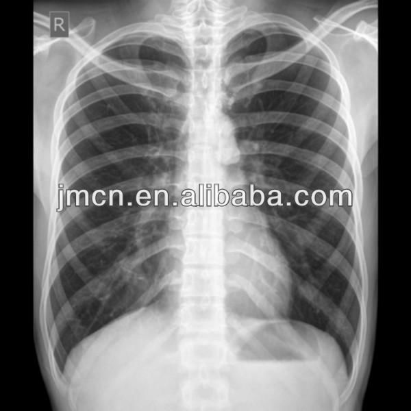 Double Layer DT2B Medical Dry Film X Ray For Agfa Thermal Printer