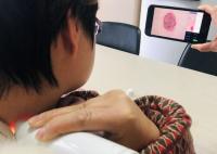 L'analyse visuelle de peau et de cuir chevelu de Dermatoscope de dispositif médical usinent la résolution d'image 1280*720