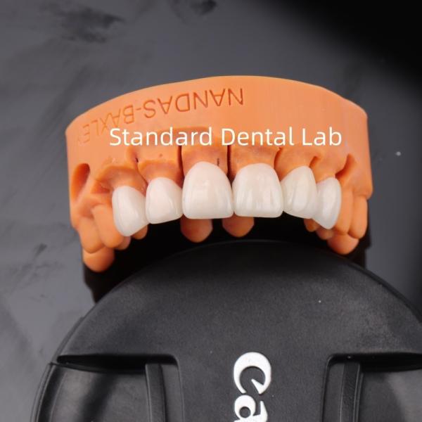 Удобство и функциональность с цифровой CAD CAM стоматологической лаборатории Прозрачный слойный цирконий мост