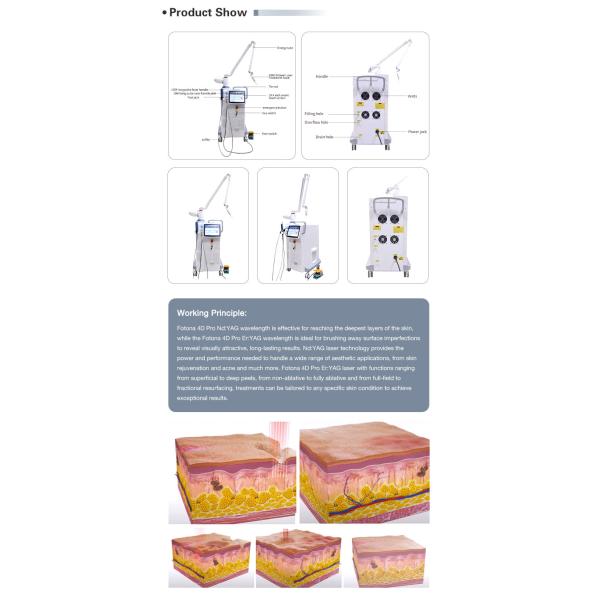 5 удаление пигмента Nd Yag 1064nm машины 4D 2940nm лазера СО2 ручки частичное