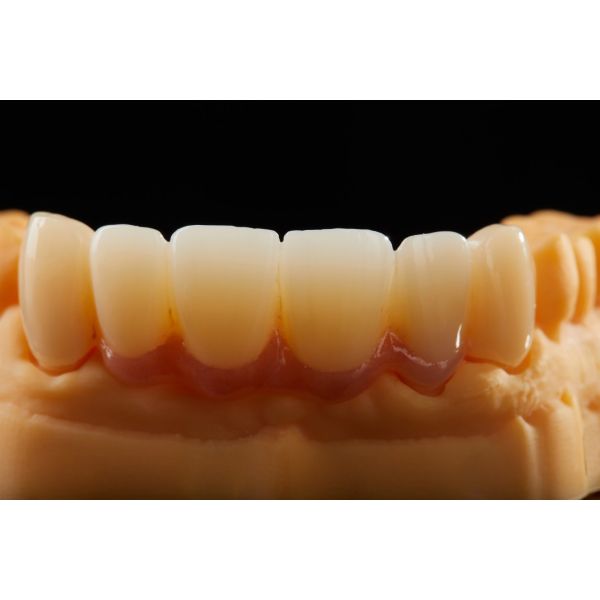 SHT-ML High Translucency Dental Zirconia Blanks Wholesale For CAD/CAM Dental Labs
