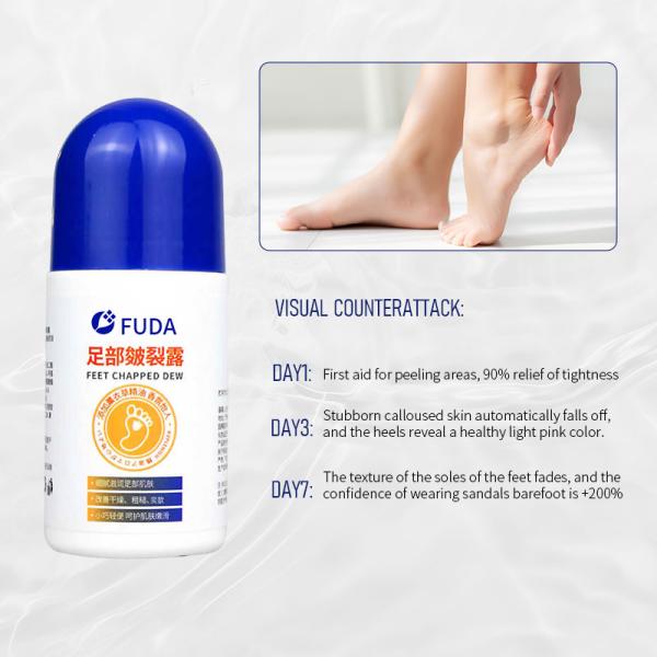 Lavender Smart Moisturizing Heel Crack Repair Lotion Nourishing Dry And Cracked Heels