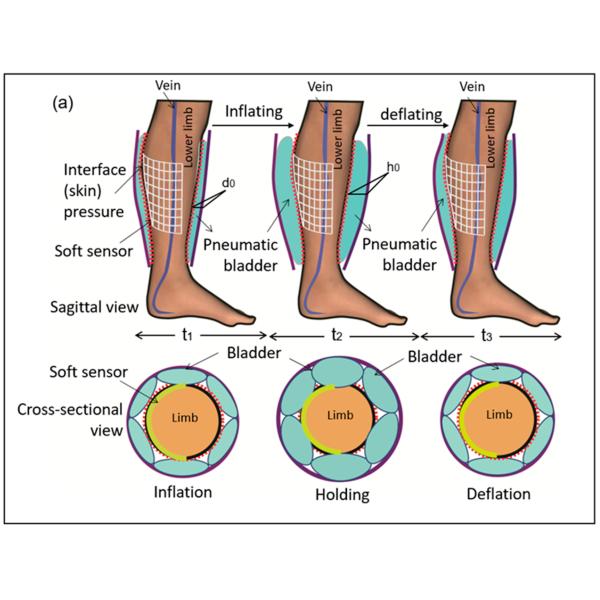 DVT Pump Intermittent Pneumatic IPC Air Compression System Class II