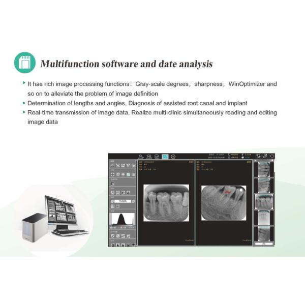 CR Imaging Plate Intraoral Dental X Ray Film Scanner