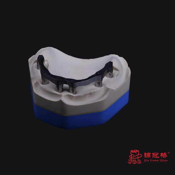 3D Printing Titanium Bridge Malone Glazed for Dental Implant Case