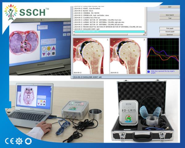 Professional Silver NLS 8D LRIS Quantum Therapy Analyzer 64 bit Latest Version