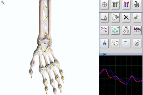 Healing Treatment Metatron Nls 4025 Hunter Body Analyzer for Bones Inspection Equipment