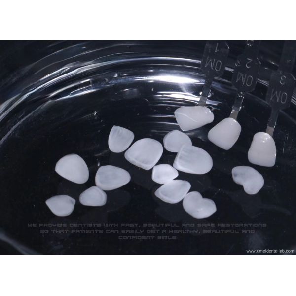 Zirconia Ceramic Veneer Natural White