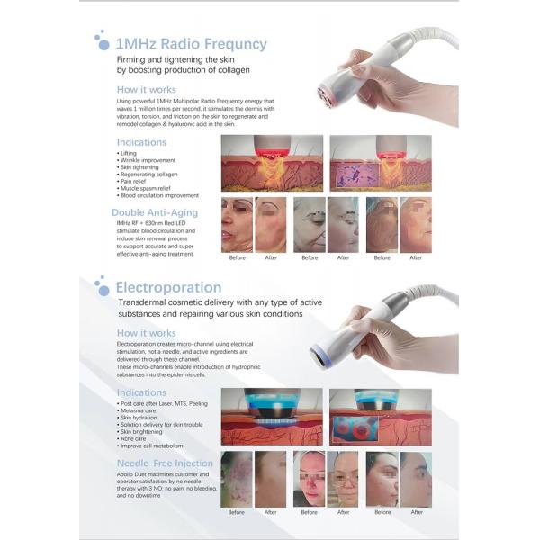 2 в 1 Криоэлектропорационный мезотерапевтический аппарат для охлаждения кожи лица