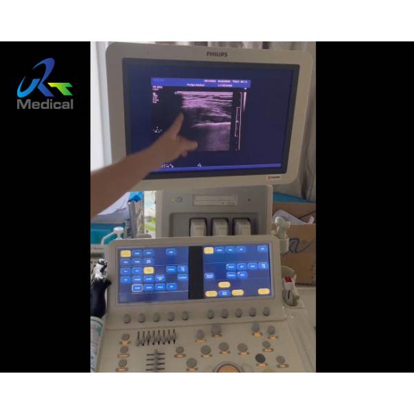 IE33 Ultrasound Machine Repair Small Parts Probe Image Loss