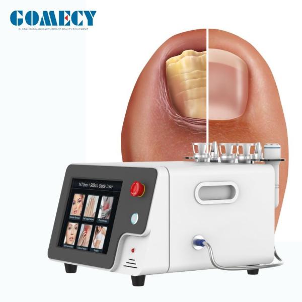 Multifunctional Physical Therapy And Body Beauty Device 980nm 1470nm Laser Beauty Machine