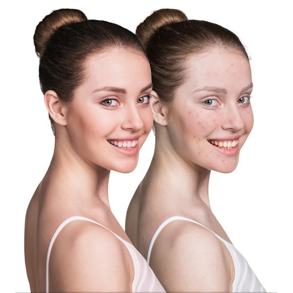 ODM Cosmetic Mushroom Head Makeup Brush Synthetic Hair Aluminun Handle