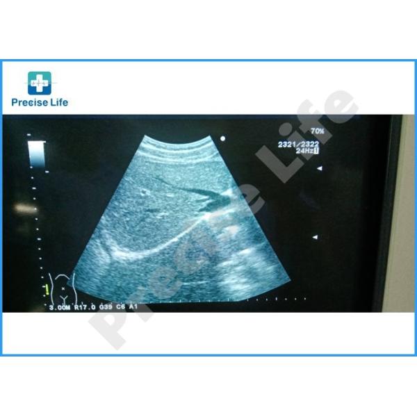 Aloka UST-9130 ultrasound probe Convex array UST-9130 Ultrasound transducer