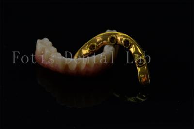 Titanium Zirconia All On 4 All On 6 Implants Full Smile Implants Lifetime Warranty