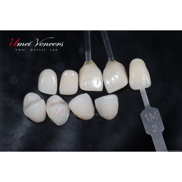 Natural Bright White Veneers
